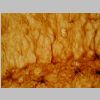 Astroglia GFAP 09.jpg